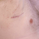 Image for article titled How Dr. Pimple Popper Deals With Someone Who Won't Wear a Mask in Her Office